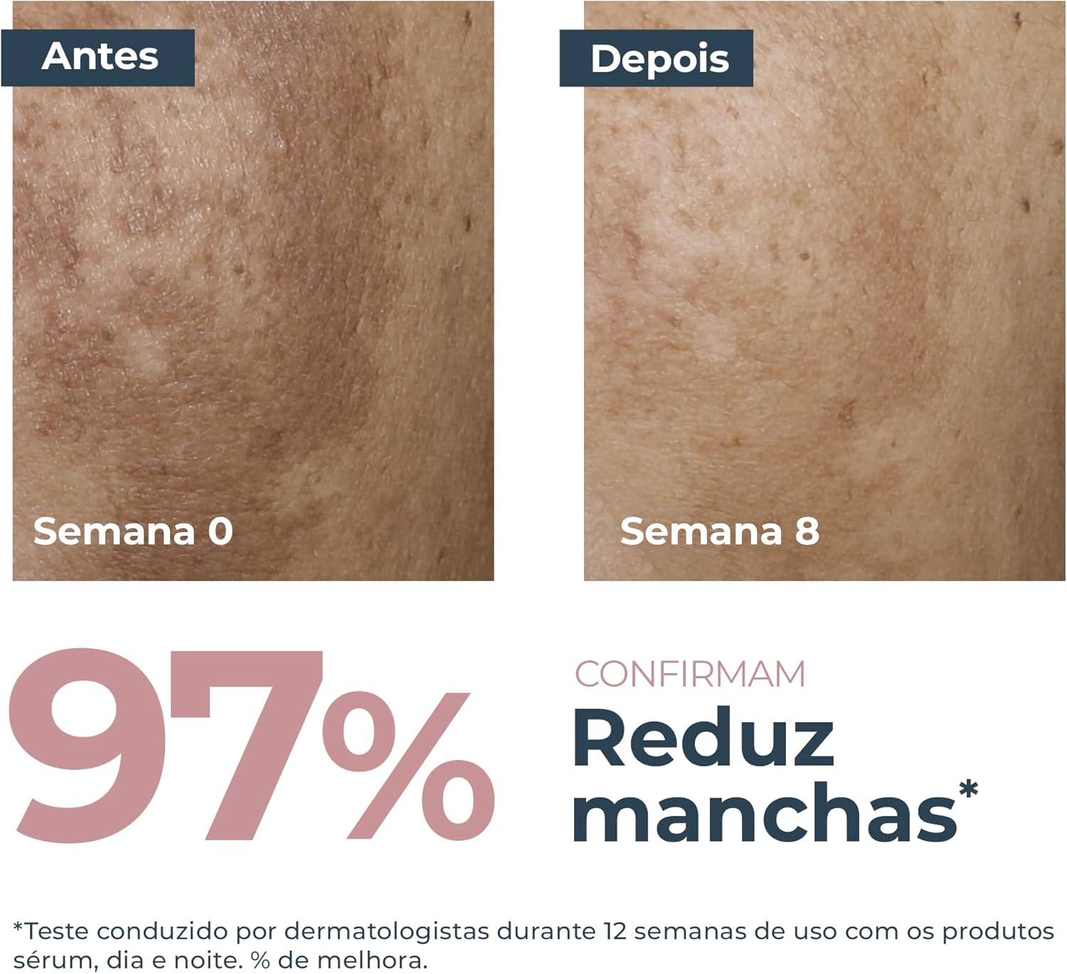 EUCERIN Dual Sérum Facial Antimanchas e Anti-idade 30ml - Image 3