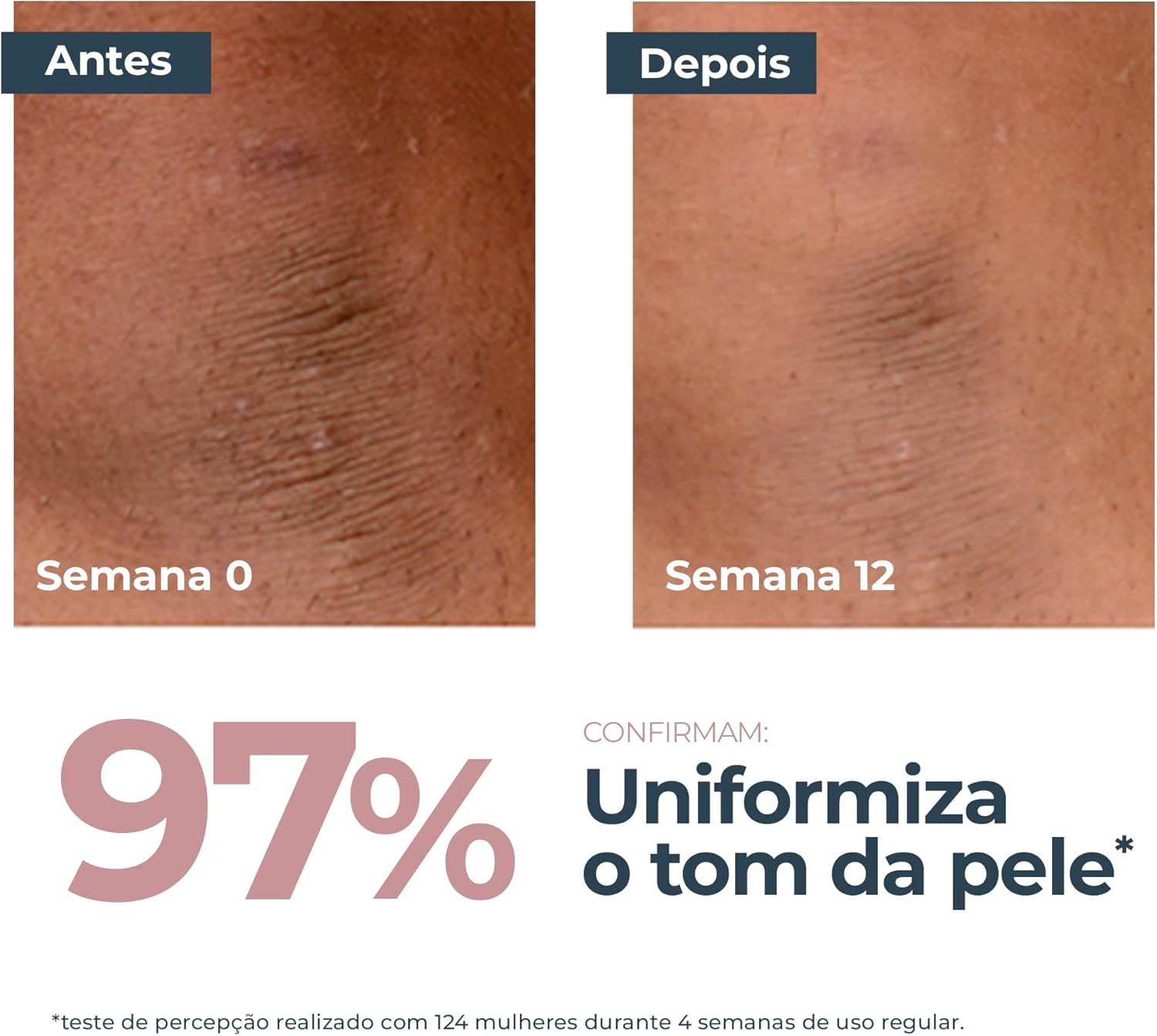 EUCERIN Creme Corporal Antimanchas Intenso 200ml - Image 4