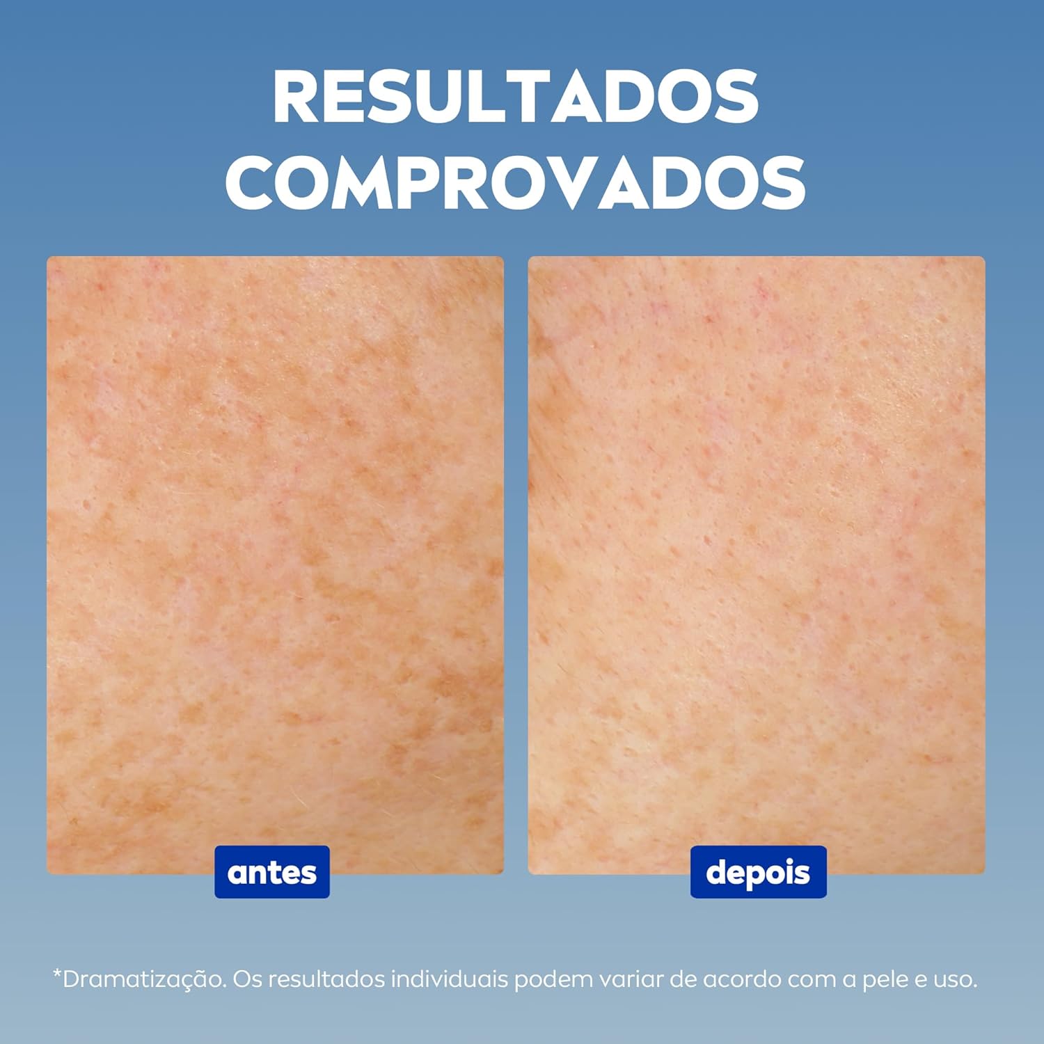 NIVEA Sérum Facial Cellular Luminous 630® ANTIMARCAS Anti-idade 30ml - Image 4